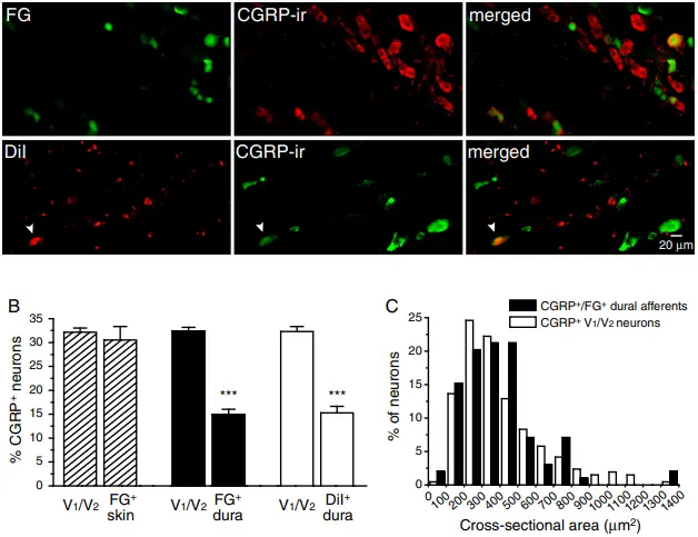 Molecular Pain 2012 TRP Channel Clustering